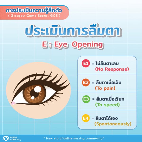 การประเมินทางระบบประสาท (Neurological signs) Nurse Soulciety